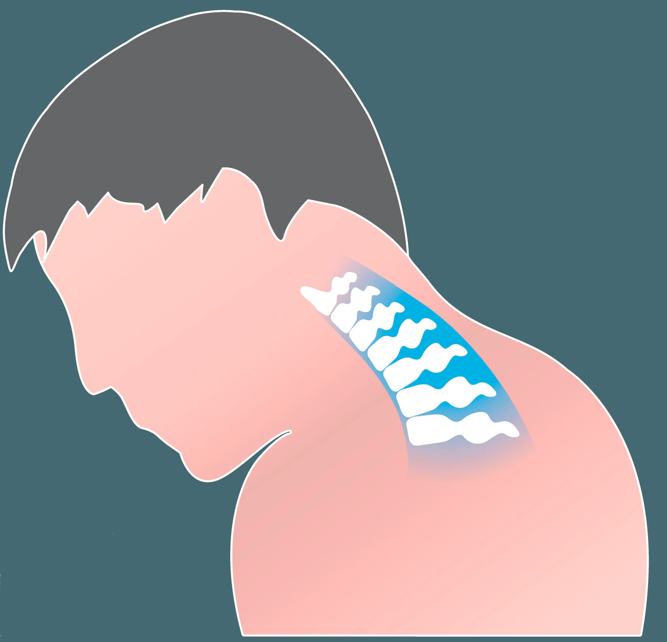 cuello-latigazo-cervical