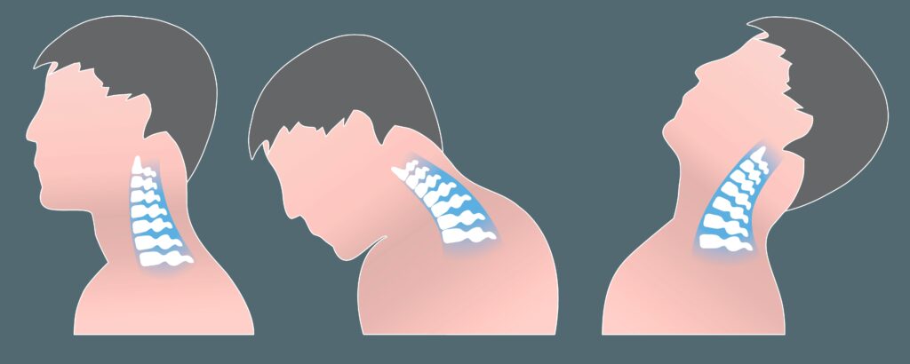 latigazo-cervical